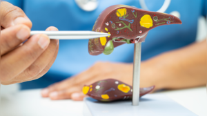 Fatty liver disease: Alcohol vs non-alcoholic fatty liver; What’s more dangerous?