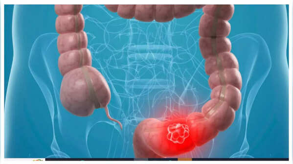 Person holding abdomen in discomfort.