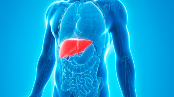 Non-alcoholic fatty liver: A silent, stubborn epidemic